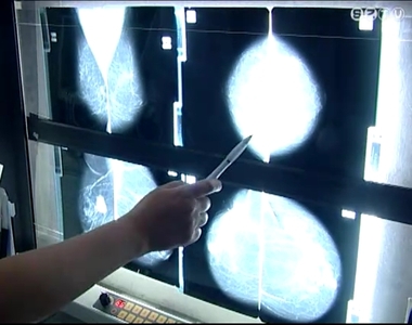 Nylt mammogrfis- s mhnyak szrs az Egszsgnapok keretben