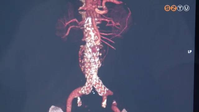 Korszer� �rseb�szeti m�dszer a Markusovszky k�rh�zban