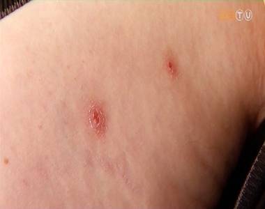 Rejt�lyes b�rki�t�sek