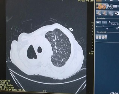 Új műtéti eljárás Új műtéti eljárás