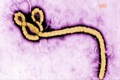A Markusovszky-k�rh�zban is k�sz�lnek az ebola-j�rv�nyra