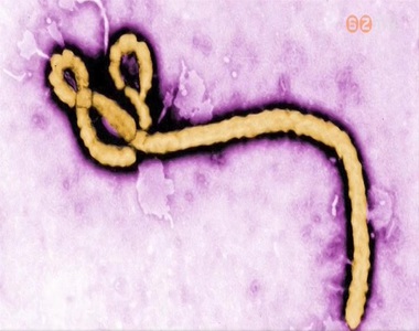 A Markusovszky-k�rh�zban is k�sz�lnek az ebola-j�rv�nyra